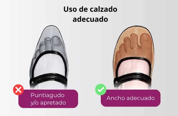 Ejemplos de calzado adecuado para prevenir uñas encarnadas y otros problemas podales